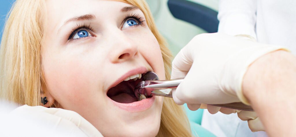 Tooth Filling Cost with Insurance