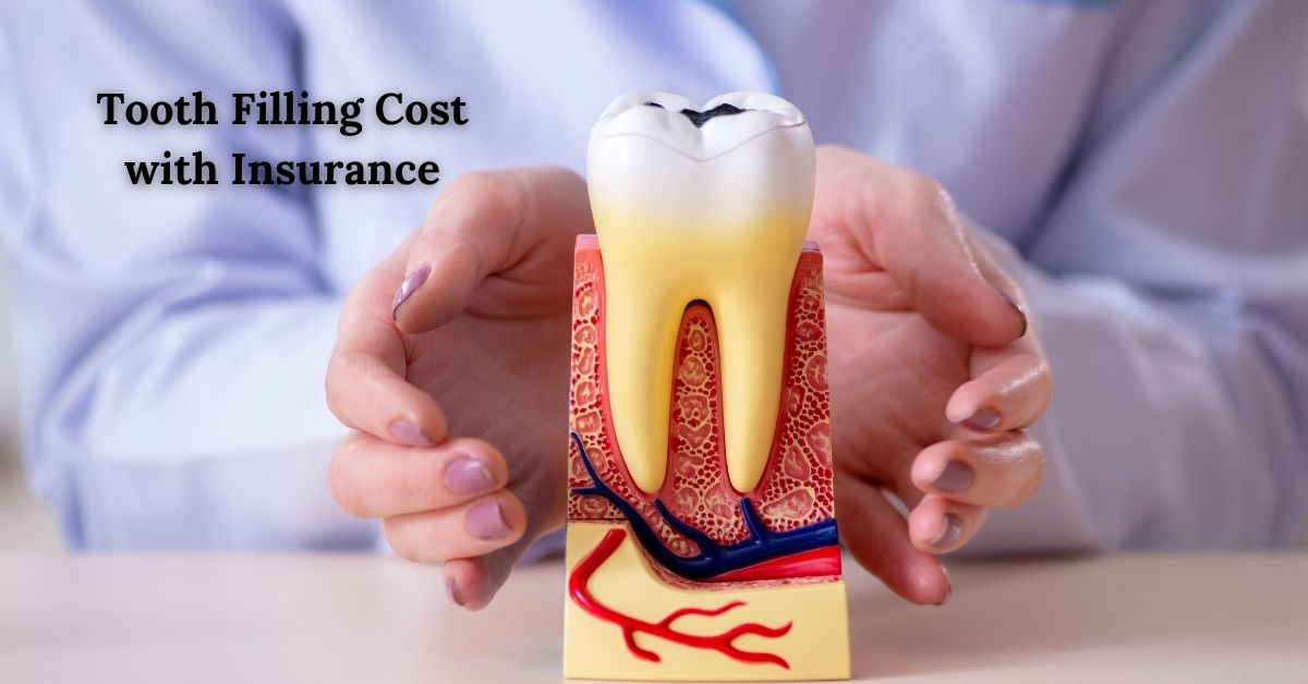 Tooth Filling Cost with Insurance